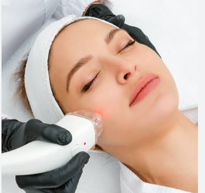 How Different Skin Concerns Require Different Types of Laser Treatments