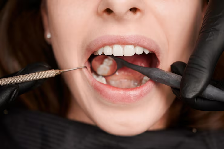 Can a Periodontist Rebuild Bone Lost to Gum Disease?