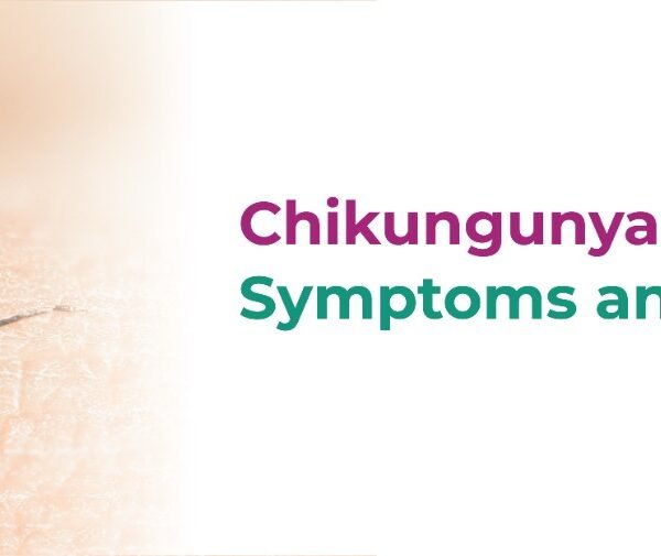 Chikungunya vs Dengue: Symptoms and Differences 