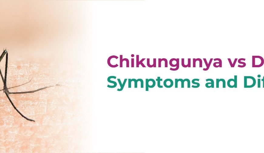 Chikungunya vs Dengue: Symptoms and Differences 