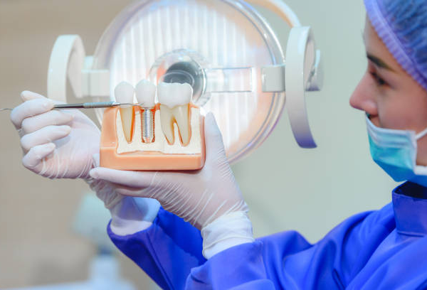 How to Find a Top Dental Implant Provider for Your Dental Needs